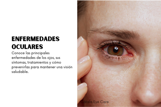 Enfermedades de los ojos: Lo que debes saber para proteger tu visión